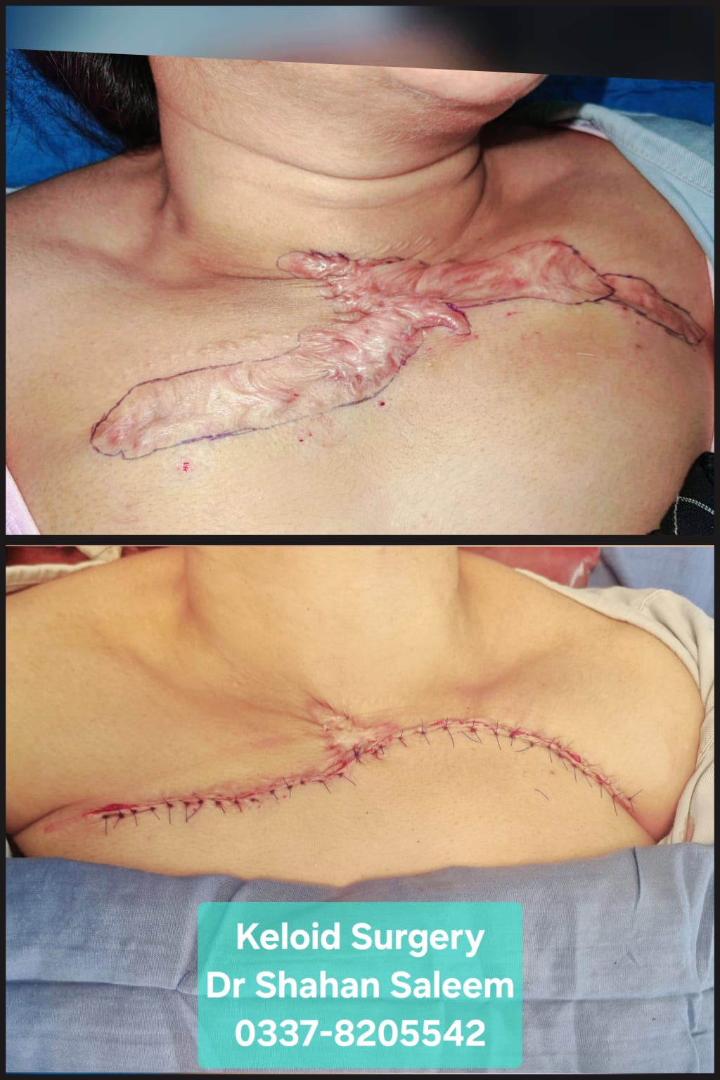 Before & After 65